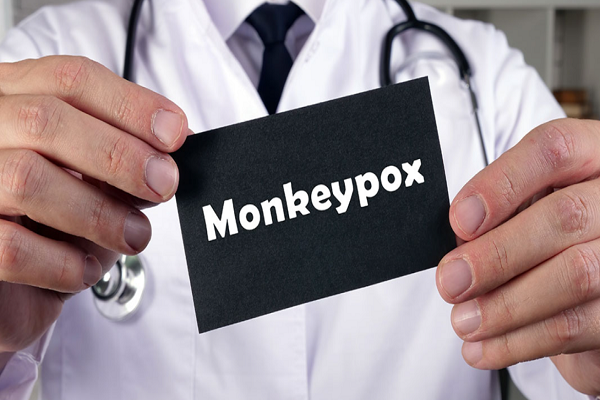Tes Deteksi Antigen Cepat Strep: Lima hal yang perlu Anda ketahui tentang monkeypox