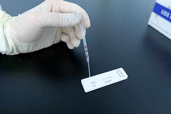 Apa artinya jika tes antigen saya positif? - bagian 2